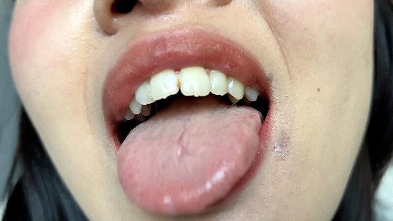 「街角で声をかけて口内観察させてもらう コールセンターアルバイト あむちゃん」のサンプル画像8枚目