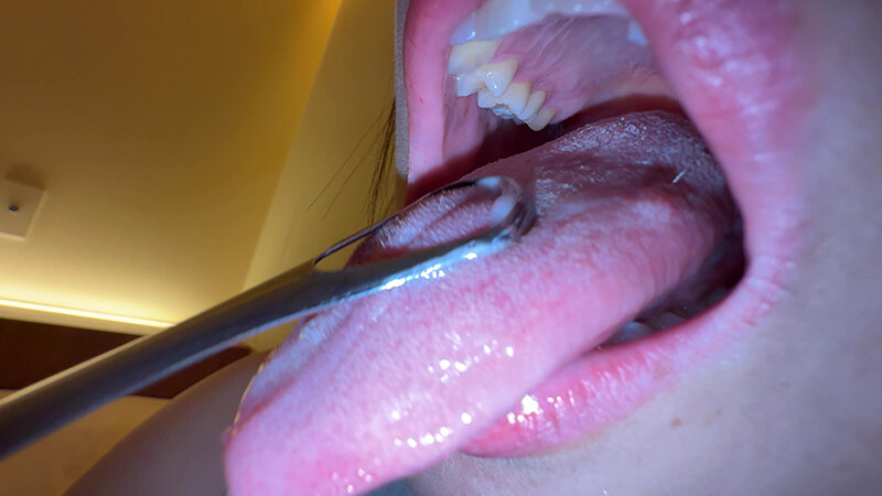 「【個人撮影】赤城穂波の舌ブラシで「汚舌苔」採取」のサンプル画像14枚目