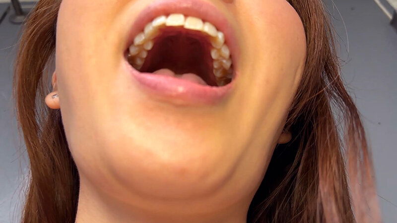 「街角で声をかけて口内観察させてもらう 商社営業 れなちゃん」のサンプル画像17枚目