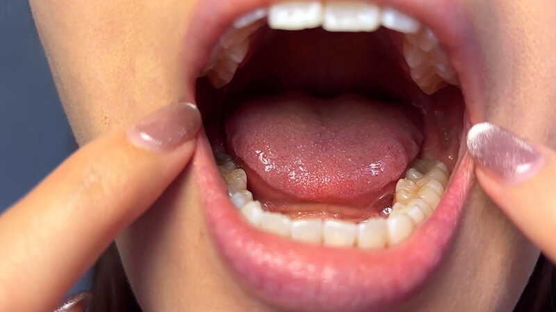 「街角で声をかけて口内観察させてもらう 商社営業 れなちゃん」のサンプル画像6枚目