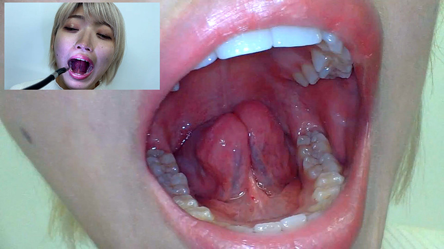 「街角で声をかけて口内観察させてもらう 美容部員 はるのちゃん」のサンプル画像5枚目