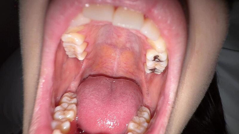 「【個人撮影】湊波流のデカ舌ディープキス&ツバ鼻吸い」のサンプル画像11枚目