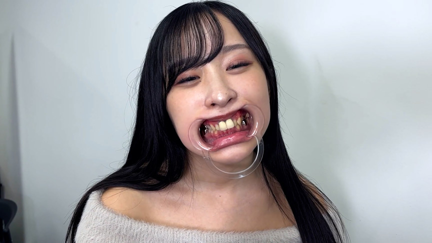「喉ちんこが可愛いゆのちゃんの口内観察」のサンプル画像10枚目