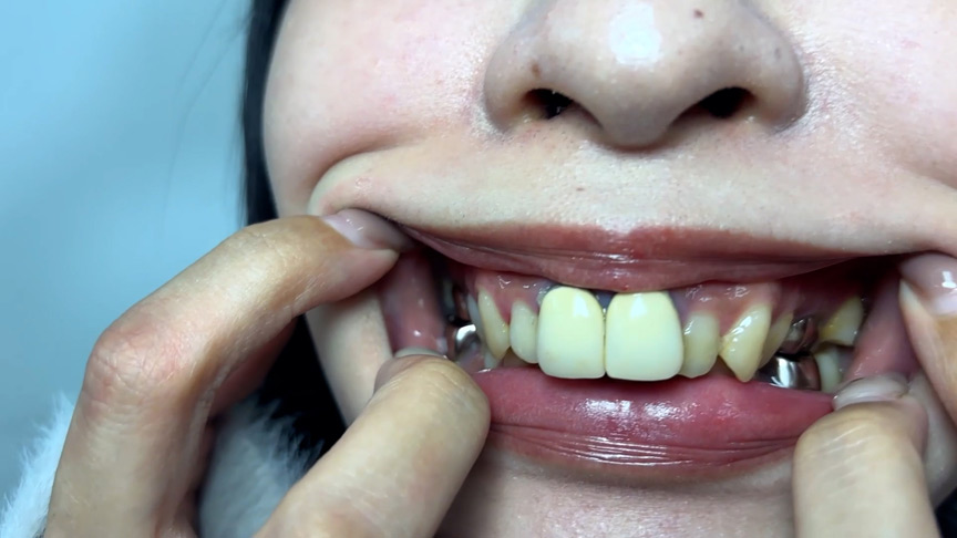 「喉ちんこが可愛いゆのちゃんの口内観察」のサンプル画像3枚目