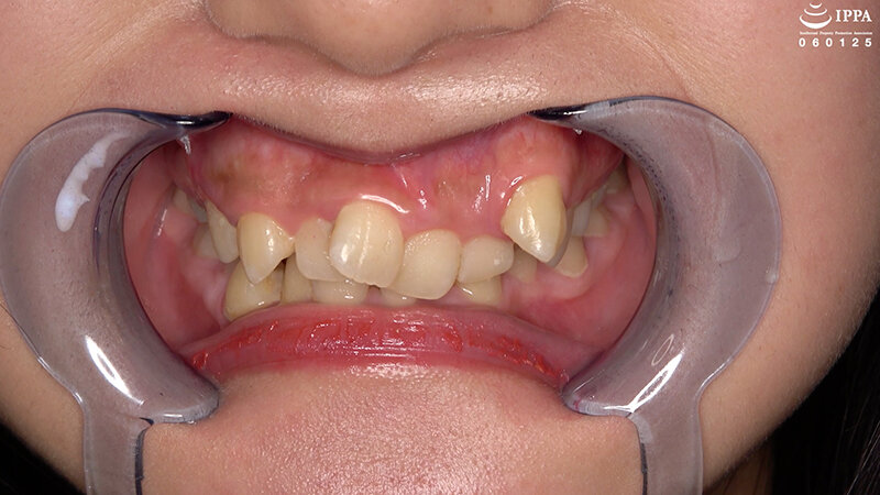 「「【歯・口腔フェチ】新人女優相楽さゆなちゃんの口内観察＆巨大女フェチ」わかしラボWAKA-078 相楽さゆな 9」のサンプル画像2枚目