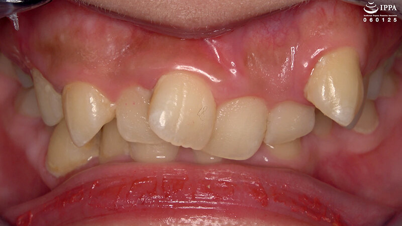 「「【歯・口腔フェチ】新人女優相楽さゆなちゃんの口内観察＆巨大女フェチ」わかしラボWAKA-078 相楽さゆな 9」のサンプル画像3枚目