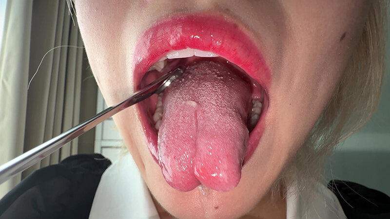 「【個人撮影】安堂はるの 舌ブラシで「汚舌苔」採取」のサンプル画像10枚目