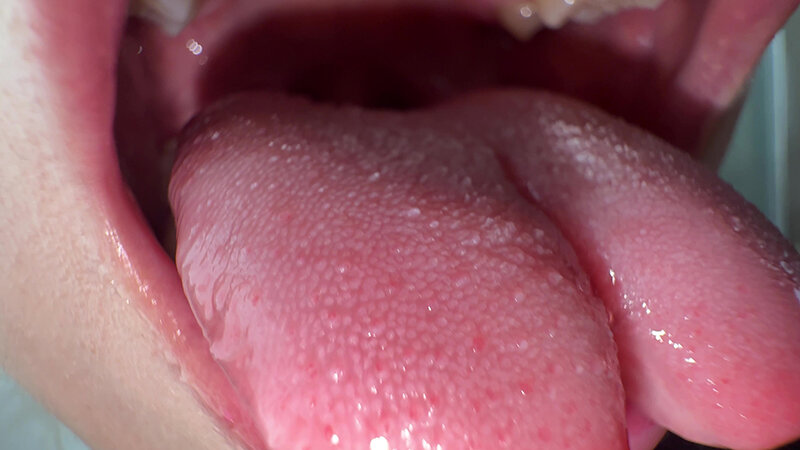 「【個人撮影】安堂はるの 舌ブラシで「汚舌苔」採取」のサンプル画像13枚目