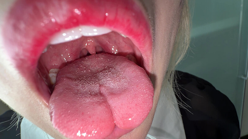 「【個人撮影】安堂はるの 舌ブラシで「汚舌苔」採取」のサンプル画像14枚目