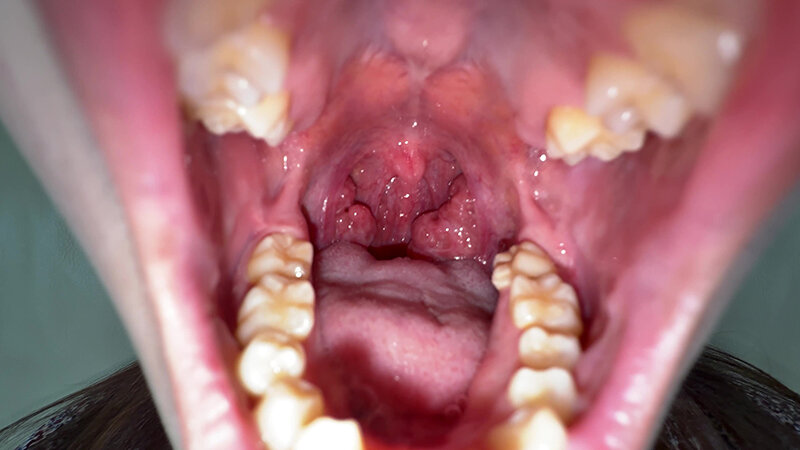 「【水月みお】素人お姉さんをナンパ!初めての喉奥体験と舌・八重歯観察の個人撮影動画」のサンプル画像7枚目