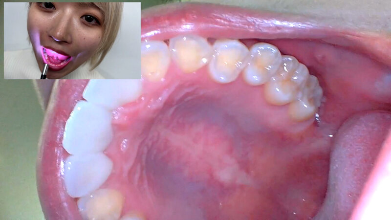 「街角で声をかけて口内観察させてもらう 美容部員 はるのちゃん」のサンプル画像17枚目