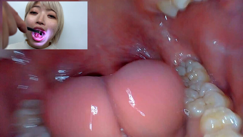 「街角で声をかけて口内観察させてもらう 美容部員 はるのちゃん」のサンプル画像18枚目