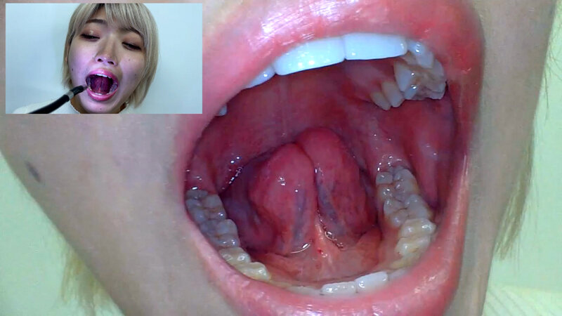 「街角で声をかけて口内観察させてもらう 美容部員 はるのちゃん」のサンプル画像19枚目