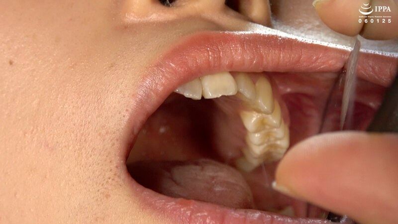 「「【口内・歯】人気女優 江澄ゆゆチャンの激レア口内・のどちんこ観察!」江澄ゆゆ」のサンプル画像10枚目