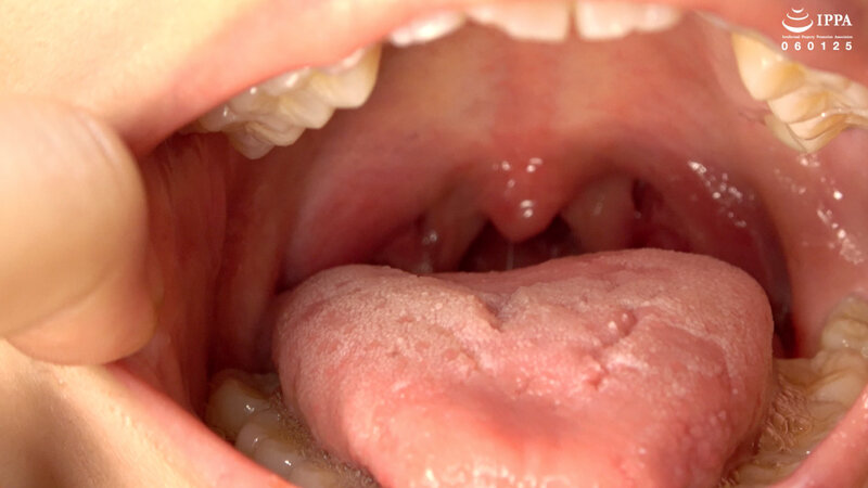 「「【口内・歯】人気女優 江澄ゆゆチャンの激レア口内・のどちんこ観察!」江澄ゆゆ」のサンプル画像4枚目