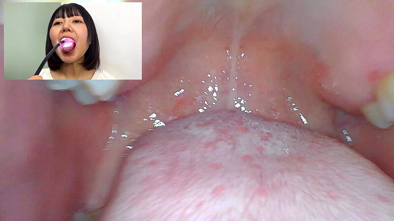 「街角で声をかけて口内観察させてもらう テレビ局AD みゆりちゃん」のサンプル画像11枚目