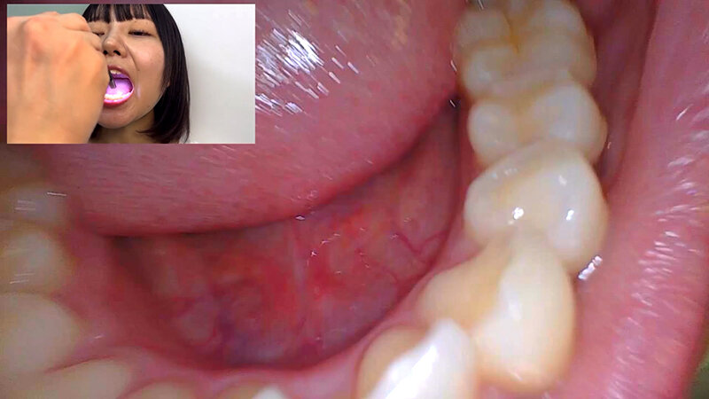 「街角で声をかけて口内観察させてもらう テレビ局AD みゆりちゃん」のサンプル画像14枚目