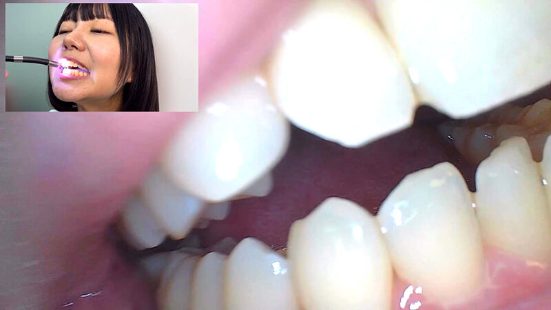 「街角で声をかけて口内観察させてもらう テレビ局AD みゆりちゃん」のサンプル画像15枚目