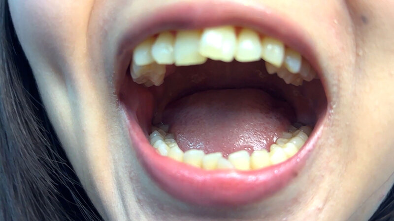 「街角で声をかけて口内観察させてもらう テレビ局AD みゆりちゃん」のサンプル画像2枚目