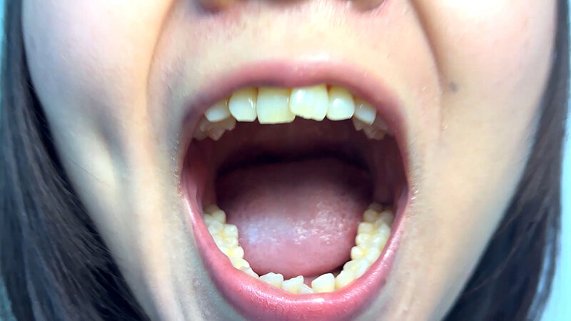 「街角で声をかけて口内観察させてもらう テレビ局AD みゆりちゃん」のサンプル画像3枚目