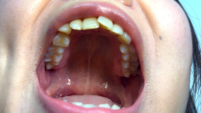 「街角で声をかけて口内観察させてもらう テレビ局AD みゆりちゃん」のサンプル画像4枚目