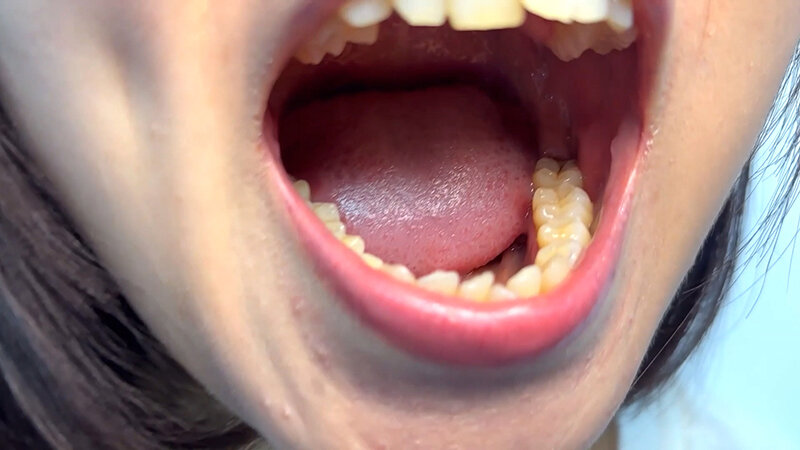 「街角で声をかけて口内観察させてもらう テレビ局AD みゆりちゃん」のサンプル画像5枚目