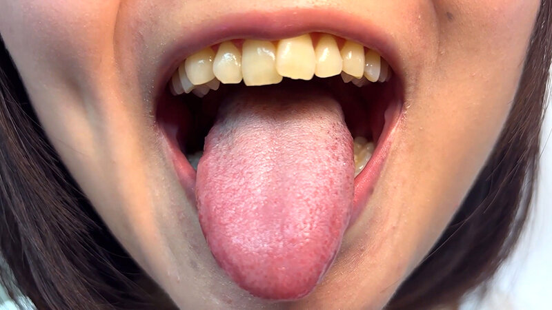 「街角で声をかけて口内観察させてもらう テレビ局AD みゆりちゃん」のサンプル画像7枚目