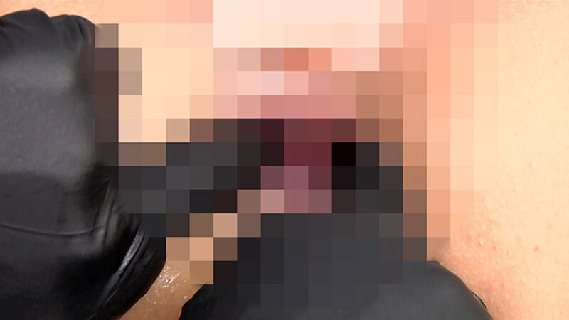 「尻穴拡張クリニック 臨床手順に基づくアナル拡張記録」のサンプル画像12枚目